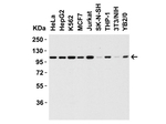 NALP3 Antibody in Western Blot (WB)