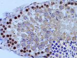NANOG Antibody in Immunohistochemistry (Paraffin) (IHC (P))