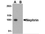 Nephrin Antibody in Western Blot (WB)