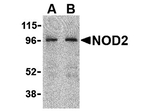 NOD2 Antibody in Western Blot (WB)