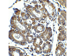 Noxa Antibody in Immunohistochemistry (Paraffin) (IHC (P))