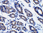 Noxa Antibody in Immunohistochemistry (Paraffin) (IHC (P))