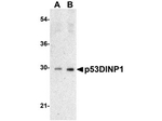 p53DINP1 Antibody in Western Blot (WB)
