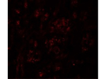 PION Antibody in Immunocytochemistry (ICC/IF)