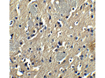 PION Antibody in Immunohistochemistry (Paraffin) (IHC (P))
