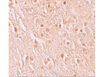 PION Antibody in Immunohistochemistry (Paraffin) (IHC (P))