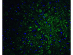 PRDM16 Polyclonal Antibody