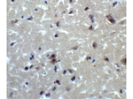 PRDM16 Antibody in Immunohistochemistry (Paraffin) (IHC (P))