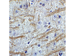 PRDM16 Antibody in Immunohistochemistry (Paraffin) (IHC (P))