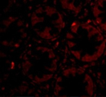 PTK7 Polyclonal Antibody