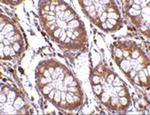 PTK7 Antibody in Immunohistochemistry (Paraffin) (IHC (P))