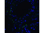 RIG-1 Antibody in Immunocytochemistry (ICC/IF)