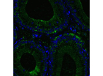 RIG-1 Polyclonal Antibody