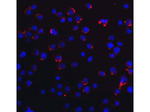 RIG-1 Antibody in Immunocytochemistry (ICC/IF)