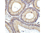 RIG-1 Antibody in Immunohistochemistry (Paraffin) (IHC (P))