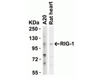 RIG-1 Antibody in Western Blot (WB)