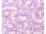 RIP3 Antibody in Immunohistochemistry (Paraffin) (IHC (P))