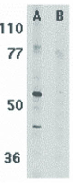 RIP3 Antibody in Western Blot (WB)