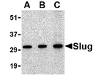 Slug Antibody in Western Blot (WB)