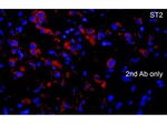 ST2 Antibody in Immunocytochemistry (ICC/IF)