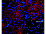 ST2 Antibody in Immunocytochemistry (ICC/IF)