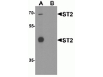 ST2 Antibody in Western Blot (WB)