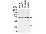 ST2 Antibody in Western Blot (WB)