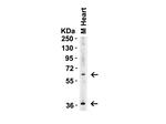 ST2 Antibody in Western Blot (WB)