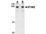 STIM2 Antibody in Western Blot (WB)