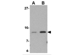 Strep-tag II Antibody in Western Blot (WB)
