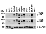 TACE Antibody in Western Blot (WB)