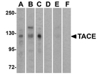TACE Antibody in Western Blot (WB)