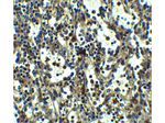 TLR3 Antibody in Immunohistochemistry (Paraffin) (IHC (P))