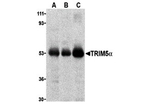 TRIM5 alpha Antibody in Western Blot (WB)