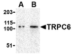 TRPC6 Antibody in Western Blot (WB)