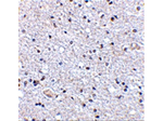 TSLP Antibody in Immunohistochemistry (Paraffin) (IHC (P))