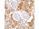 XIAP Antibody in Immunohistochemistry (Paraffin) (IHC (P))