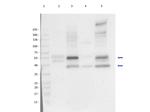SQSTM1/p62 Antibody in Western Blot (WB)