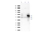 SQSTM1/p62 Antibody in Western Blot (WB)
