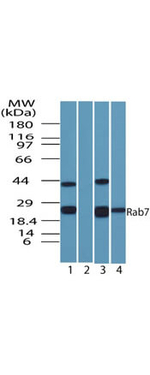 RAB7 Antibody in Western Blot (WB)