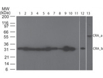 Receptor-interacting serine-threonine kinase 3 Antibody in Western Blot (WB)