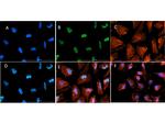 H3K9acK14ac Polyclonal Antibody