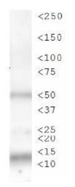 Phospho-Histone H3 (Ser28) Antibody in Western Blot (WB)