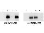 Phospho-Arhgap22 (Ser22) Polyclonal Antibody