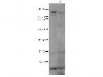 Huntington Polyclonal Antibody