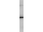 PIP5K2B Polyclonal Antibody