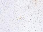 p35 Polyclonal Antibody