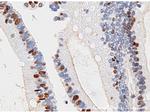 Beclin 1 Antibody in Immunohistochemistry (IHC)