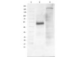 beta 1 Adrenergic Receptor Polyclonal Antibody