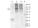 Phospho-Insulin Receptor (Tyr1361) Polyclonal Antibody